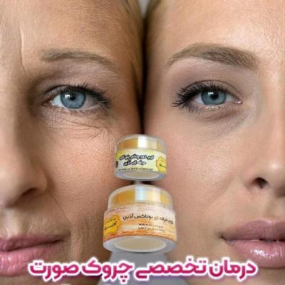 پکیج بوتاکس حرفه ای آذین رفع چین و چروکهای صورت
