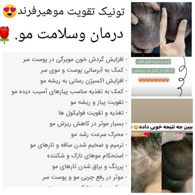 پک ضدریزش، تقویت ورویش مجددمو