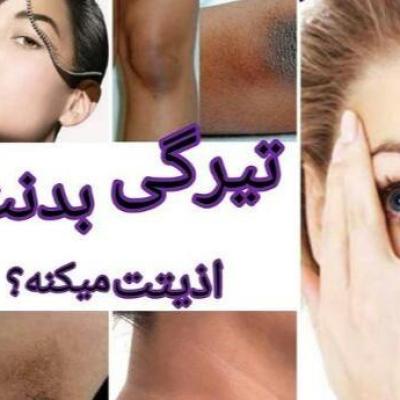 کرم روشن کننده بدن گاتیو