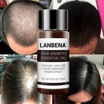 قطره تقویت مو و ریش لانبنا(سرم مو لانبنا)
